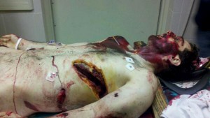 Tamerlan Tsarnaev DOA